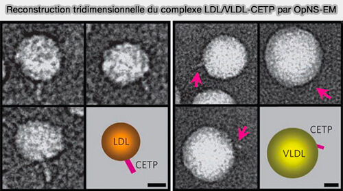 Reconstruction tridimensionnelle du complexe LDL/VLDL-CETP 