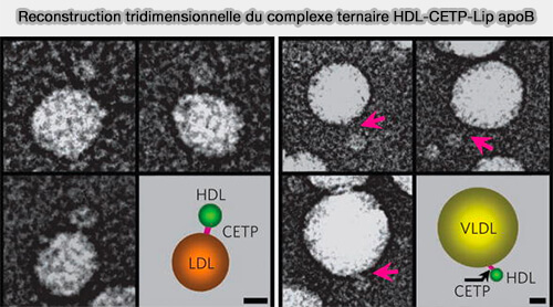 Reconstruction tridimensionnelle du complexe HDL-CETP-Lip apoB
