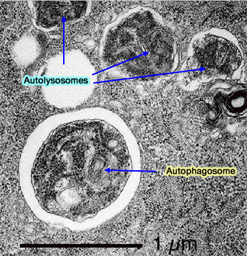 Autophagosome et autolysosomes