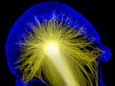 Cône de croissance d'un neurone