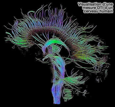 Visualisation d'une mesure DTI d'un cerveau humain