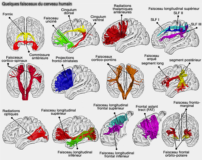 Quelques faisceaux du cerveau humain