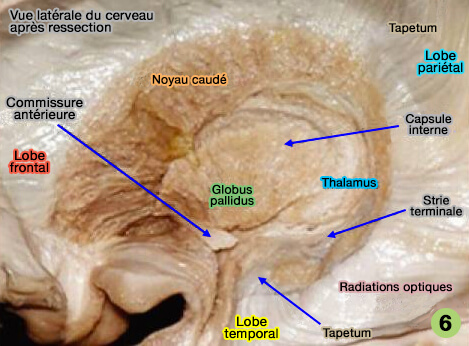 Tapetum