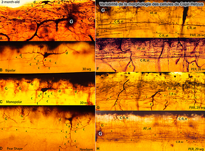 Cellules de Cajal-Retzius (cellules CR ou C-RC)