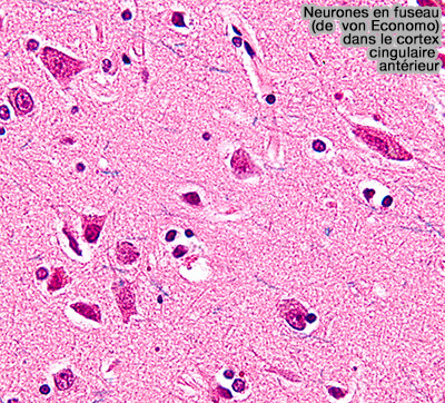 Neurones en fuseau (de von Economo)