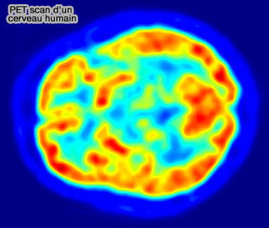 PET scan d'un cerveau humain