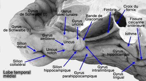 Lobe temporal médial