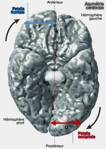 Asymétrie cérébrale