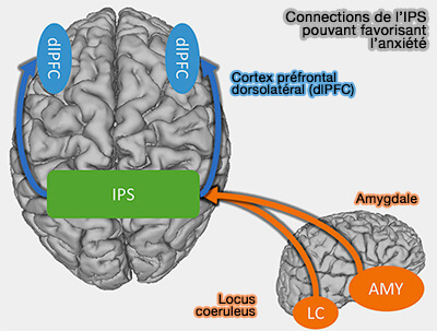 IPS et anxiété