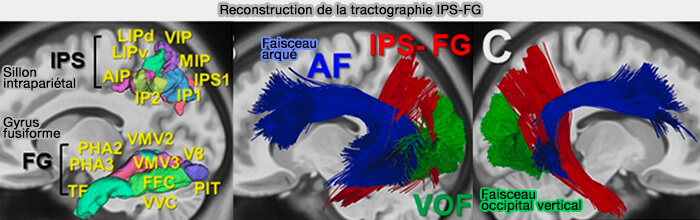 Sillons pariétaux