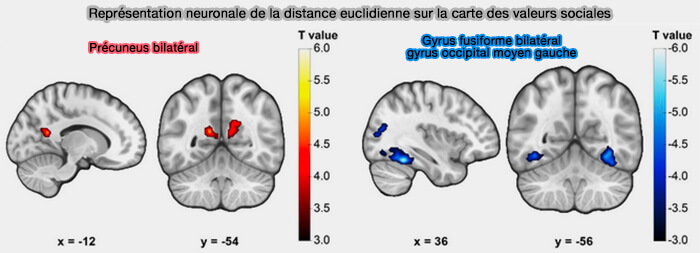 Distance euclidienne et aires cérébrales