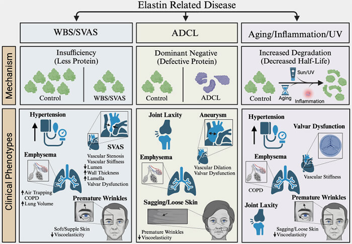 Maladies liées à l'élastine