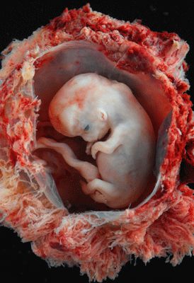 Foetus humain et annexes foetales (8 semaines)