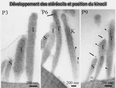 Développement des stéréocils et position du kinocil