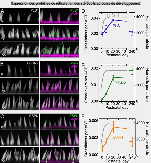 Microfilaments d'actine courts et myosines à l'extrémité des stéréocils