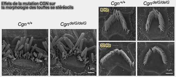 Mutations de cinguline et stétéocils